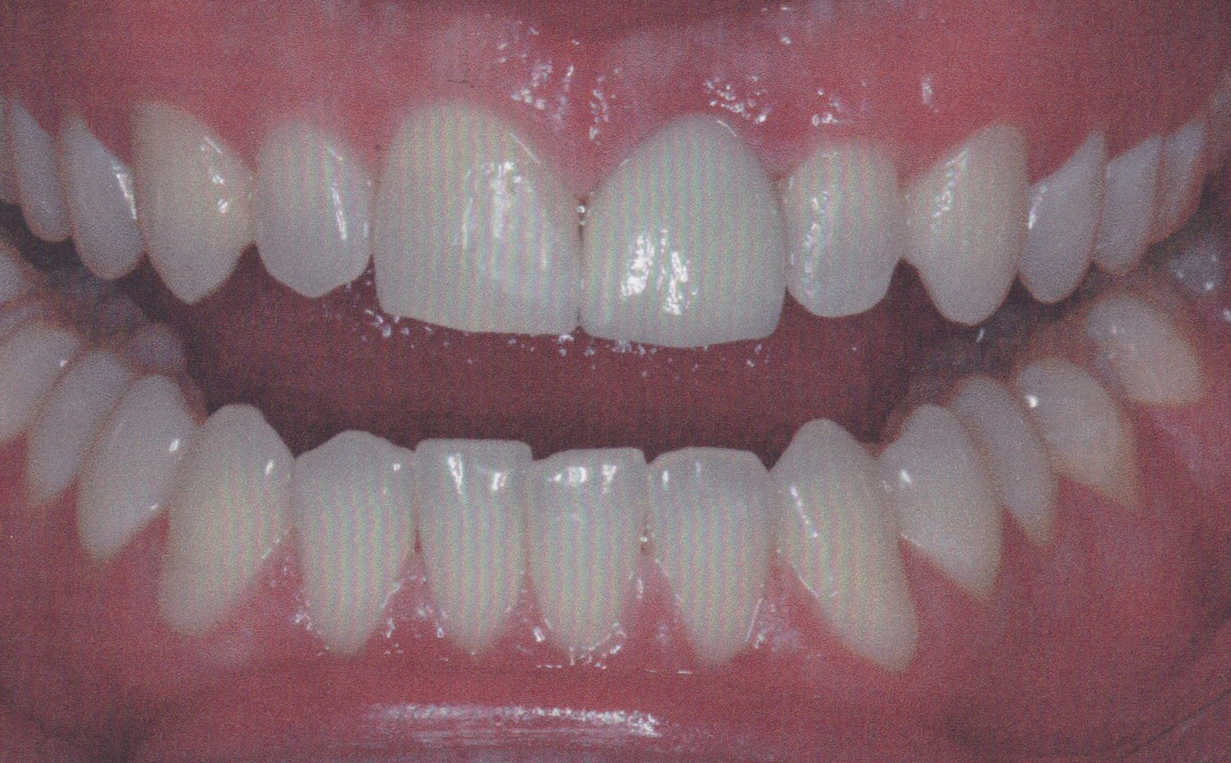 after treatment smile transformations Beach Dental Center