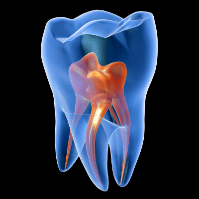 Cavities x ray beach dental center